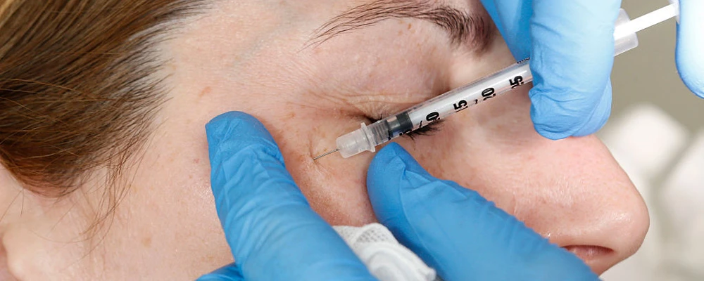 Птоз и ботулинотерапия