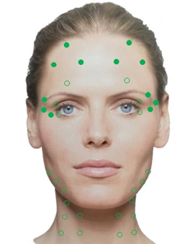 Разведение Ксеомина