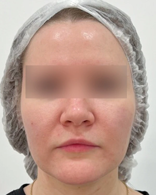 Skin Longevity