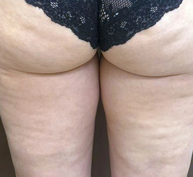 Virtue, результат