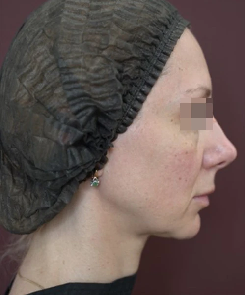 Пациент 2 до процедуры