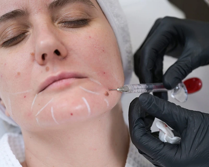 Neauvia Введение