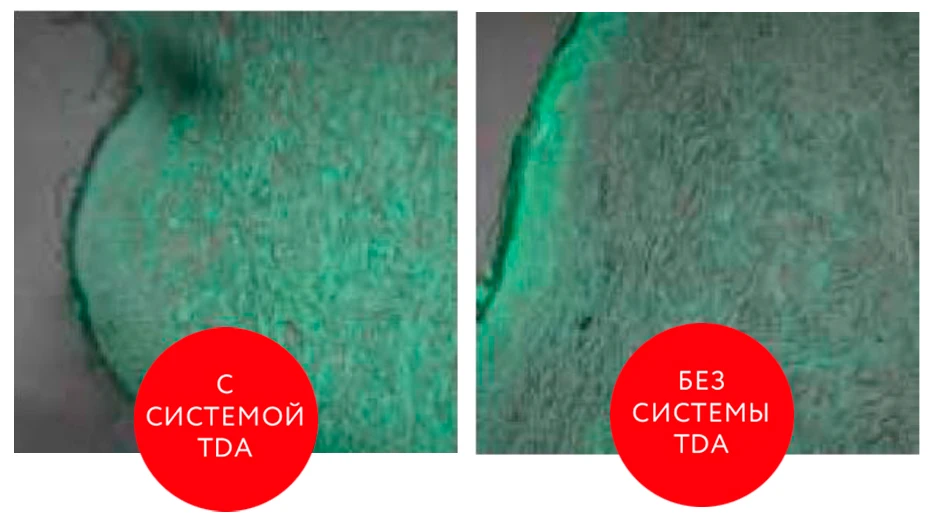 DERMADROP