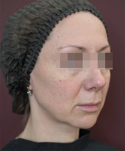 Пациент 2 до процедуры