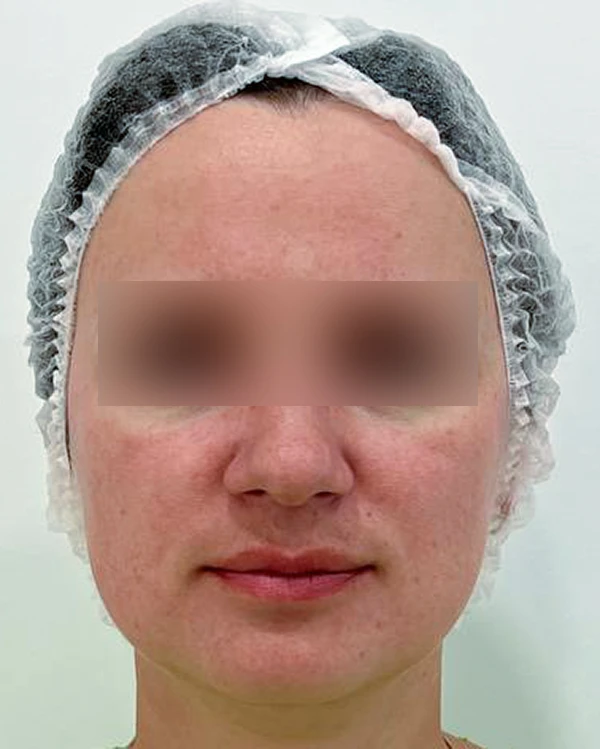 Skin Longevity