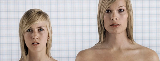 Транссексуализм