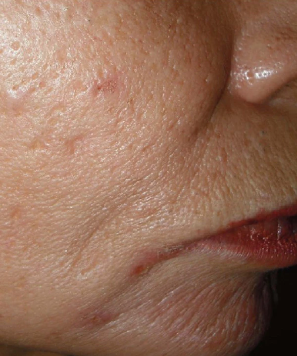 Harmony XL Pro, фото до