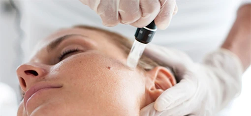 Шлифовка кожи: мезороллинг