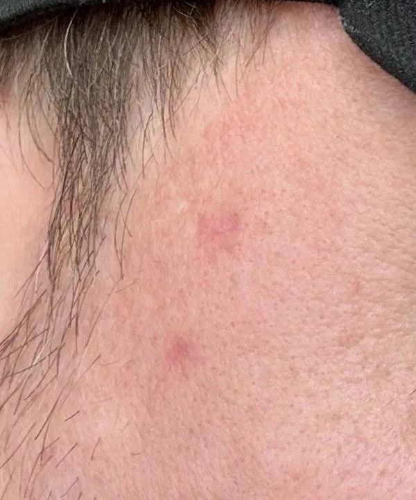 СО2 Capello Re:flex, фото после