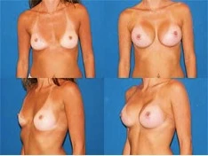 Пример груди класса 5