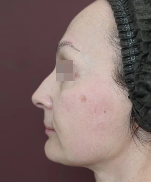 Клинический результат