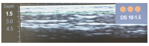 Протокол Альтера-терапия