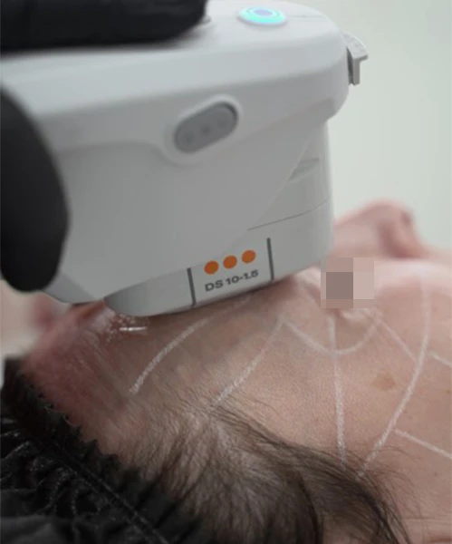 Протокол Альтера-терапия