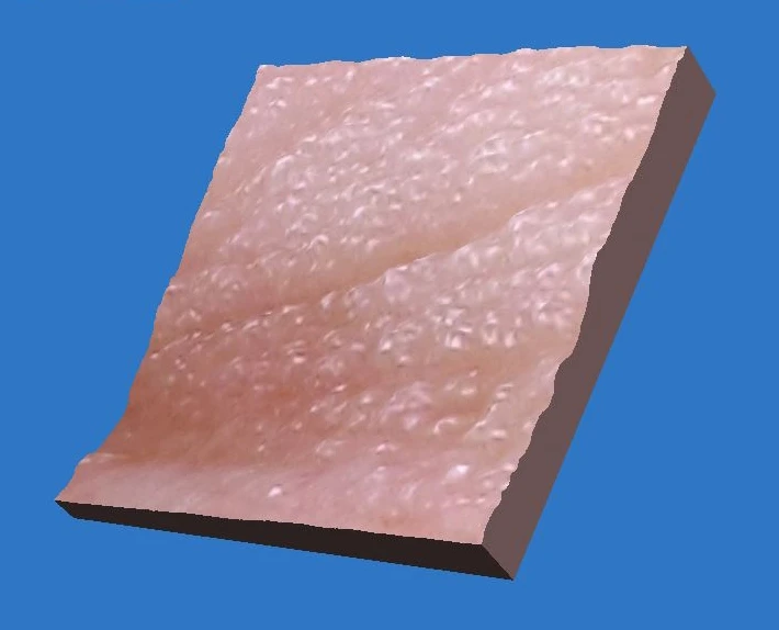 Фото 3D до проведения процедуры HELEO4