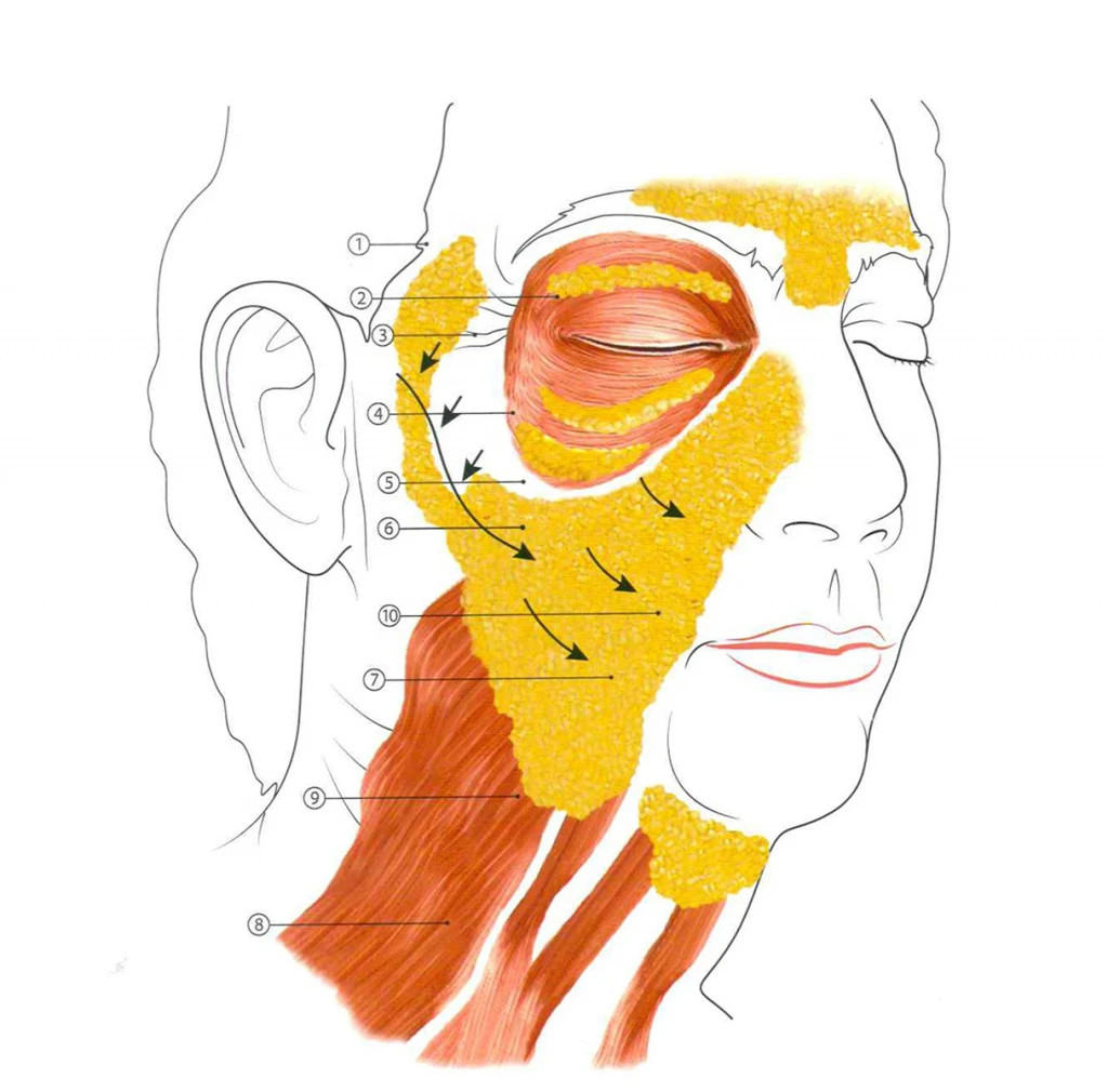 Филлинг средней трети лица: разметка