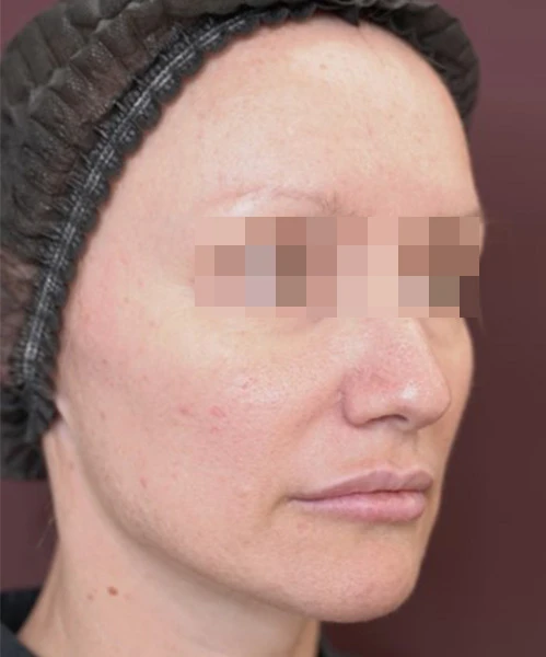 Пациент 3 до процедуры