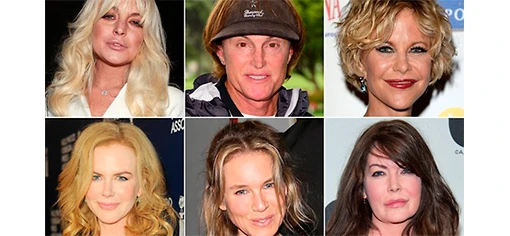 Звезды и ботокс