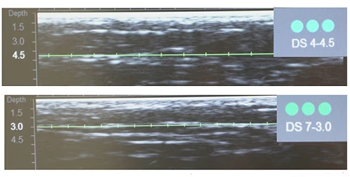 Протокол Альтера-терапия