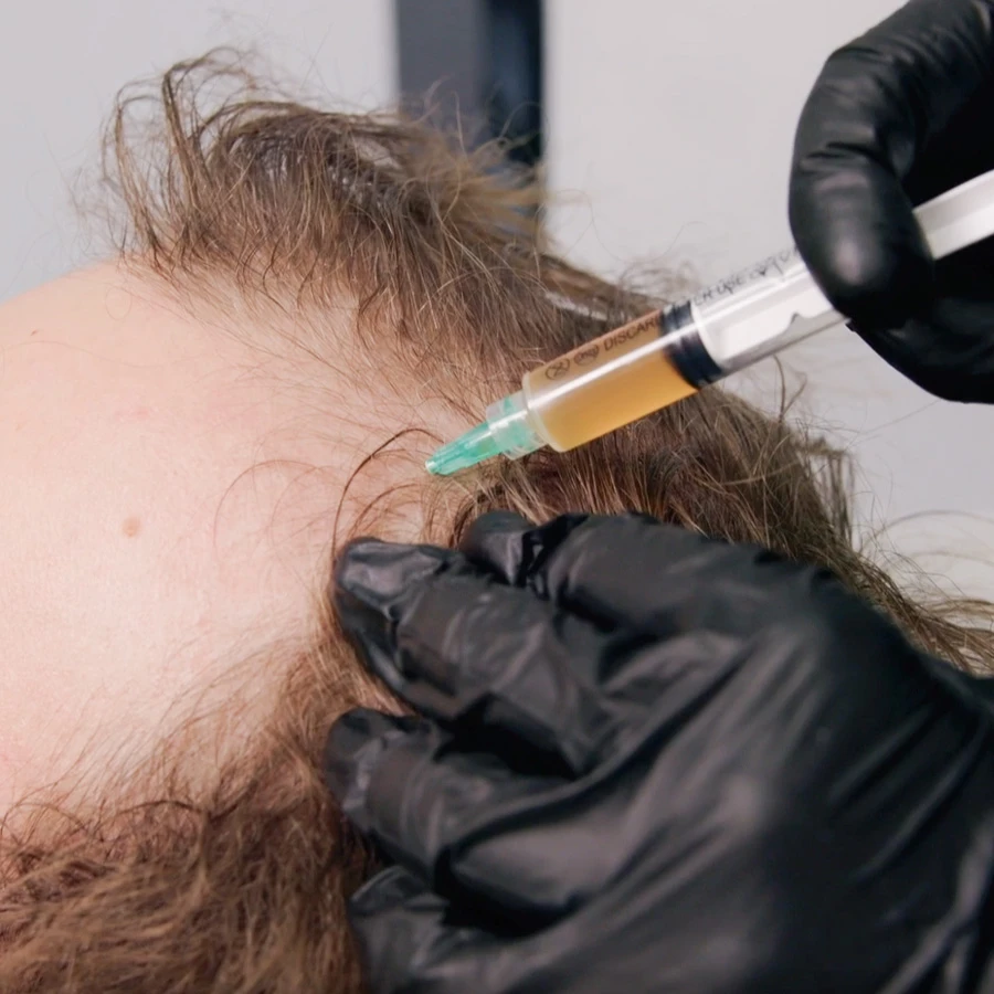 PRP-терапия Cellenis