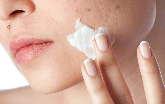 Лечение акне взрослых (Acne tarda) препаратами от Skintellectual Solutions