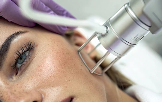 Фракционная лазерная шлифовка: популярные аппараты в России