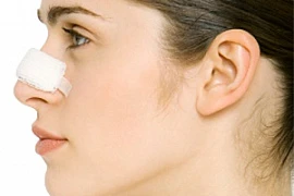 Наш опыт при восполнении опорных структур дефектов 