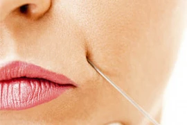 Перманентные филлеры