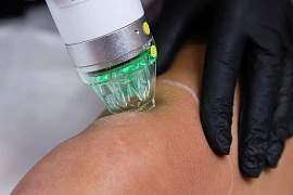 Ozempic body: клинический опыт