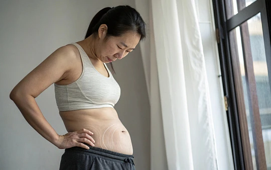 Комбинация LIFU и RF-терапии помогает уменьшить окружность живота