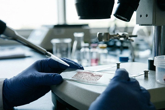 Филлер с полимолочной кислотой стимулировал образование коллагена и эластина до двух лет
