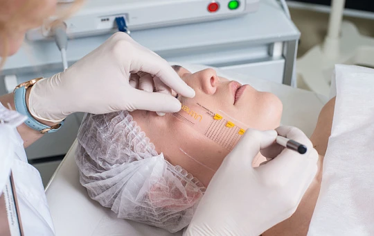 Антикризисные протоколы с Ultherapy: когда оправдана зональная коррекция?