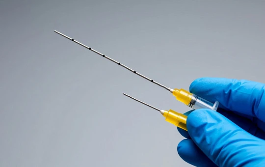 Игла или канюля: выяснили, что лучше для коррекции постакне