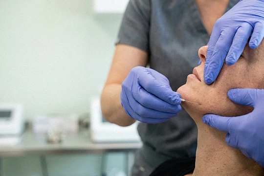 Веерная инъекция ботулотоксина уменьшила ширину нижней трети лица