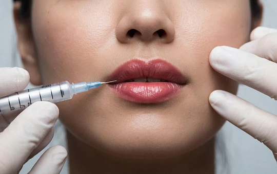 Прогноз: к 2025 году объем мирового рынка филлеров с гиалуроновой кислотой достигнет 6,04 млрд долларов