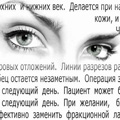 Опять реклама! И опять ФАС! Опять реклама! И опять ФАС!