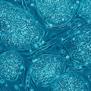 AstraZeneca и стволовые клетки AstraZeneca и стволовые клетки