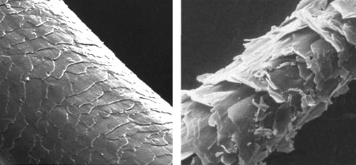 Здоровый и поврежденный волос