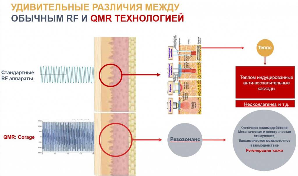 аппарат Corage