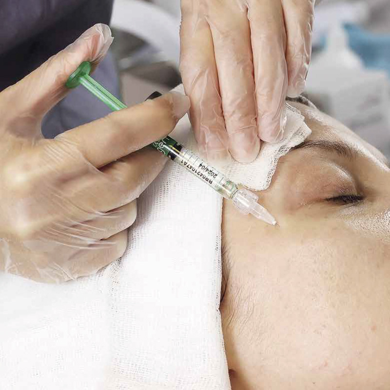 Bioregen