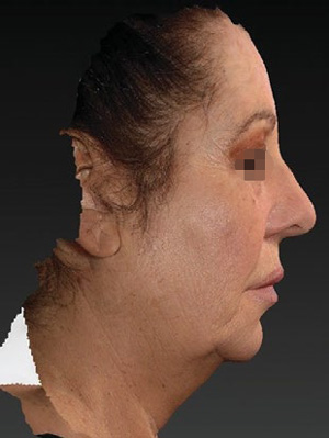 Косая и боковая проекции лица