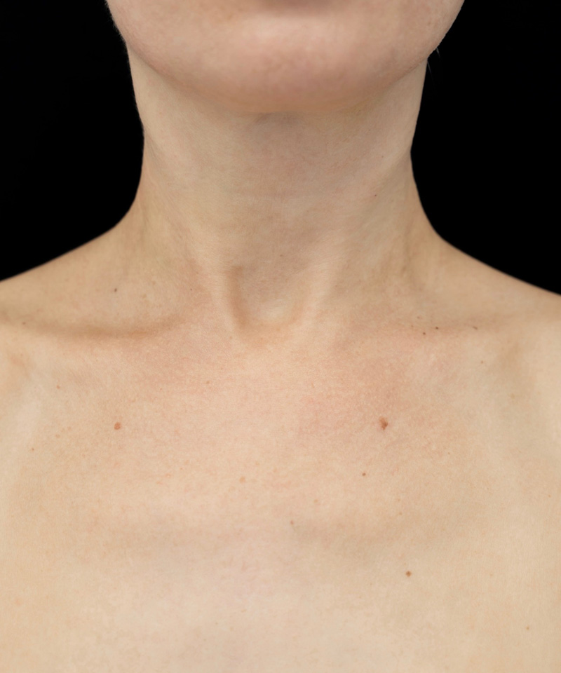 Bio-expander