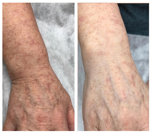 Клинический случай 4