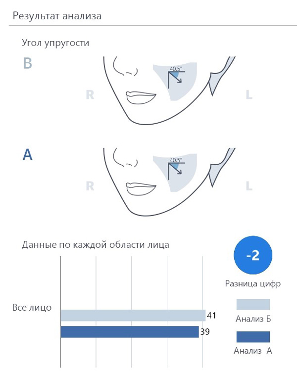 Calecim Professional Serum