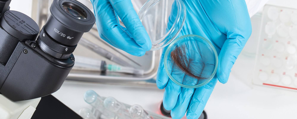 Генетика волосяных фолликулов