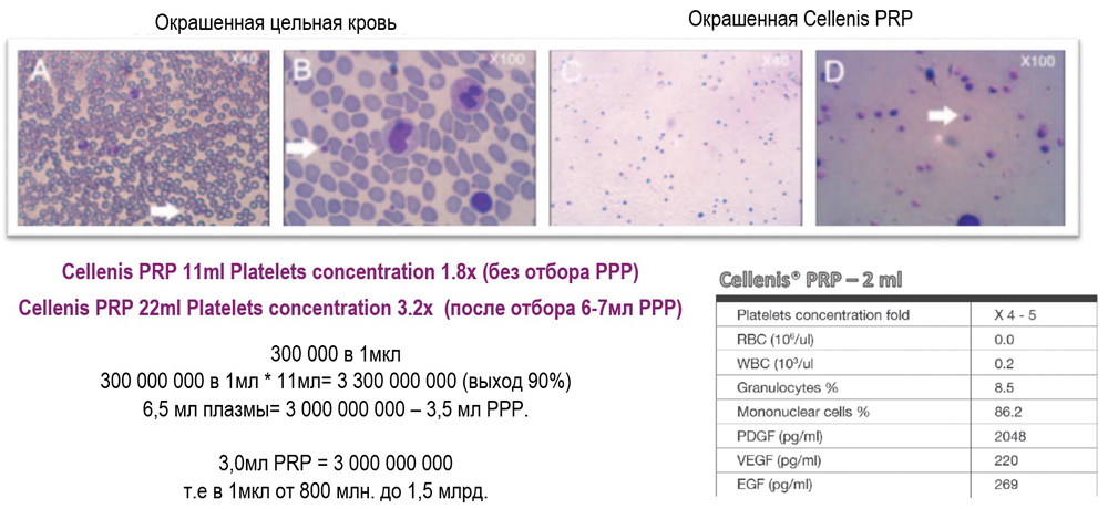 Cellenis® PRP