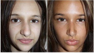 nose-300x169.jpg