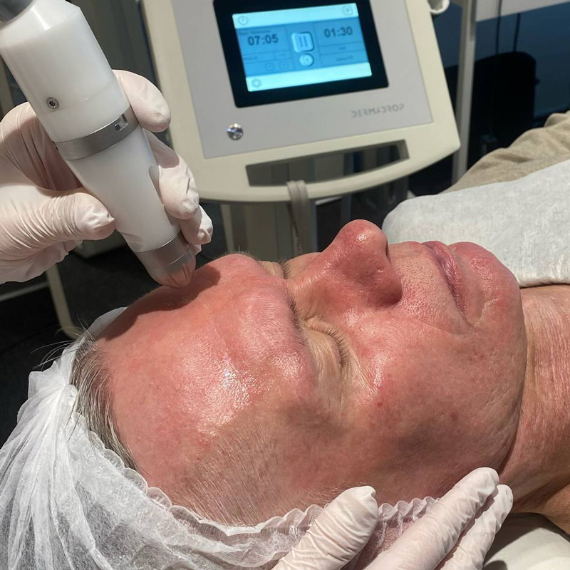 Комбинированный аппаратный уход Hydra Touch H2 + Dermadrop TDA™