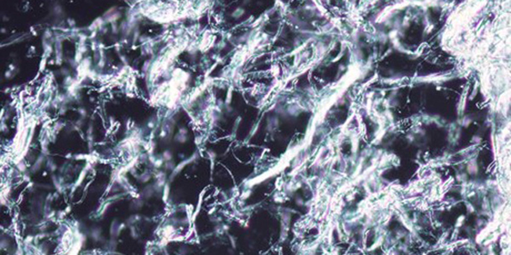 Микрофотография переплетающихся волокнистых микрочастиц коллагена MICRONONIC® в составе MIRACOLL filler