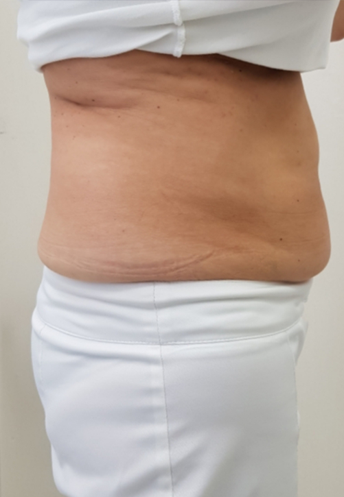 ulfit фото до