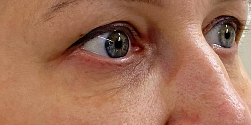 фракционный термолиз на аппарате CAPELLO CO2 Re:Flex, фото до